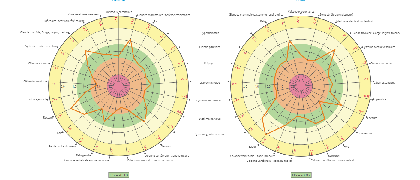 2023 04 18 13 32 1000 diagramme zone