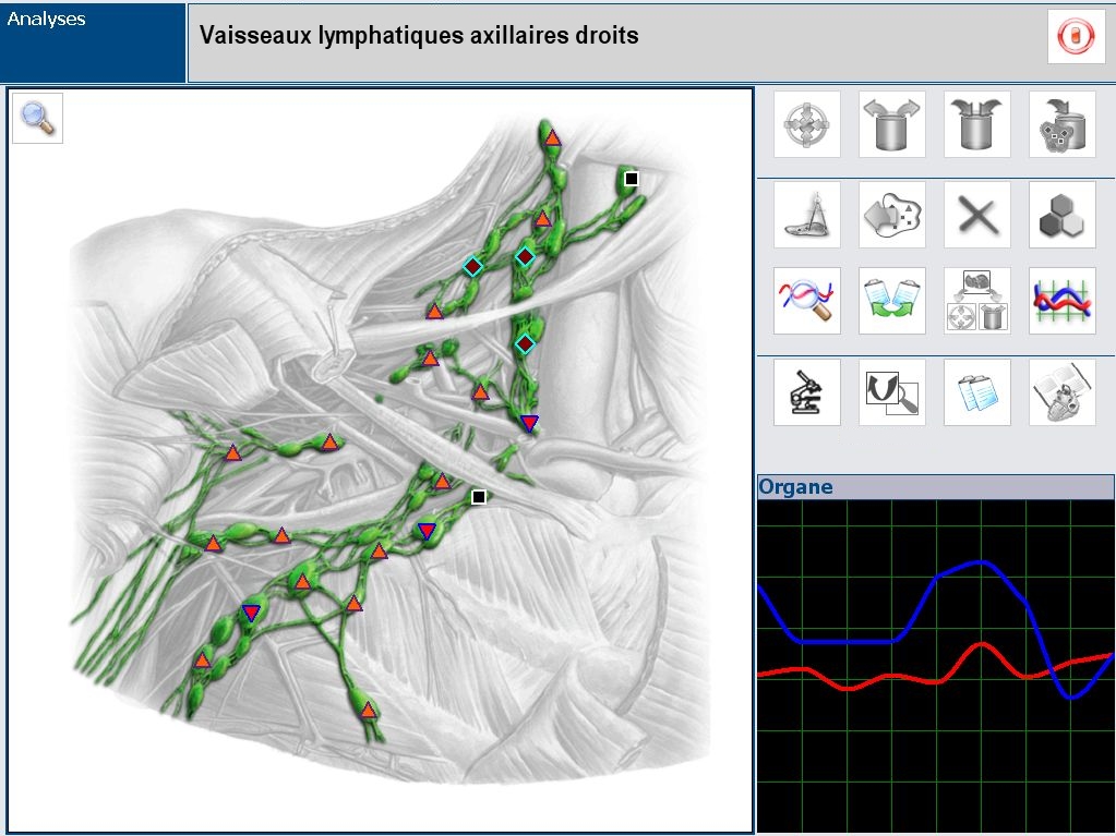 image 3d de l'aumscan 3 appareil de biorésonance